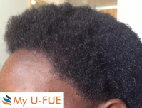 Curly hair - africans